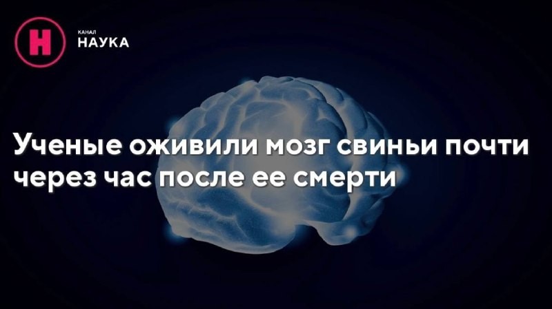 Как удалось восстановить активность мозга после остановки сердца и какую роль в...