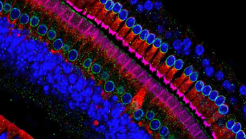 Новые клетки мозга улучшают речь и памятьИсследователи проанализировали ткани мозга пациентов с...